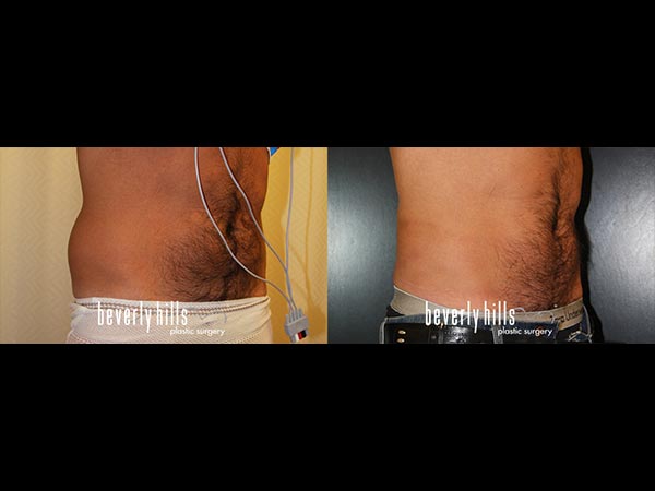 body-male-01b_04-24-2015